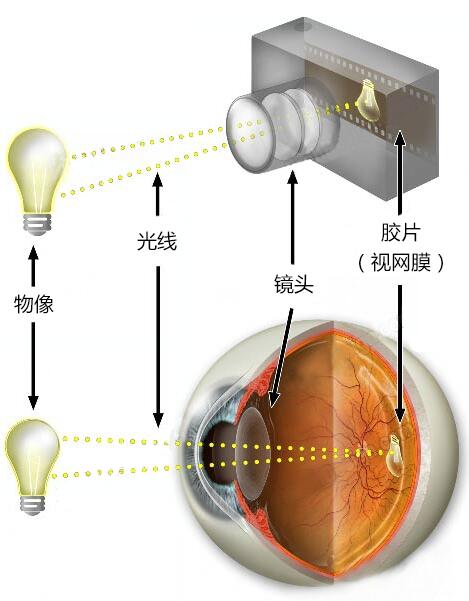最新視力矯正技術(shù)介紹與突破
