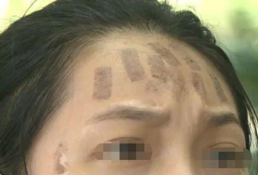 成都光子嫩膚價(jià)格，科技重塑肌膚之美