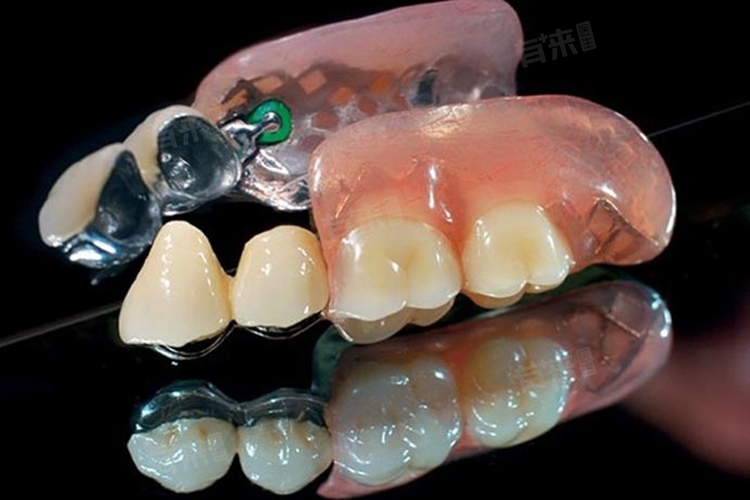 關于活動假牙價格的探討與解析