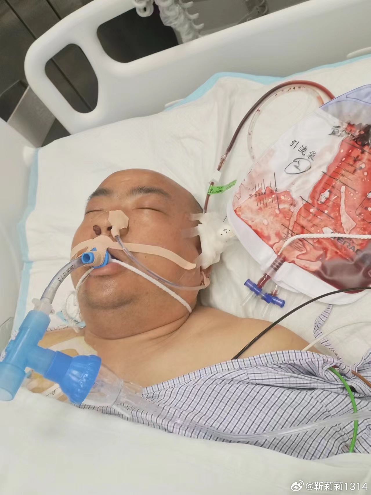 馮現(xiàn)學(xué)腦出血最新消息及應(yīng)對幫助指南(初學(xué)者與進階用戶參考)